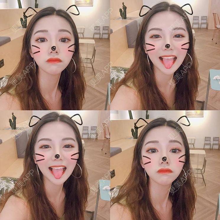 更美 - 上海御美妍医疗美容的超声提升经验 | 南京 | 超声提升