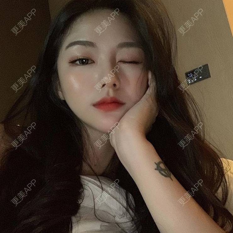 更美 - 上海御美妍医疗美容的超声提升经验 | 南京 | 超声提升