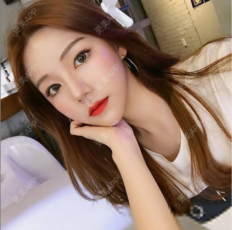 更美 - 上海御美妍医疗美容的超声提升经验 | 南京 | 超声提升