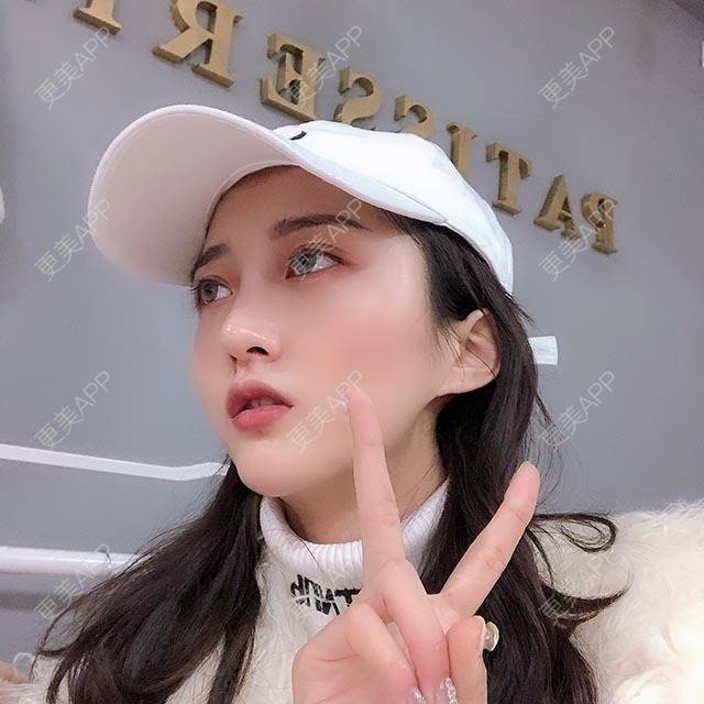 更美 - 辛酱的颧骨填充经验 | 颧骨填充 | 视频日记