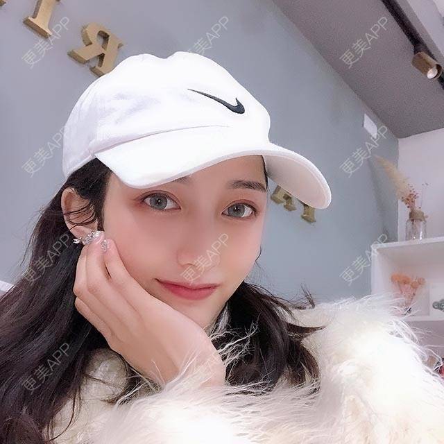 更美 - 辛酱的颧骨填充经验 | 颧骨填充 | 视频日记