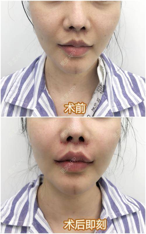 更美用户pkz1rx6x5o的人中缩短日记