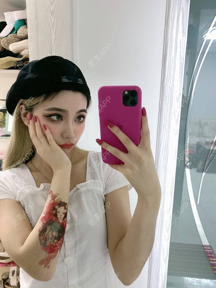 更美 - 欧美挂的全切双眼皮经验 | 全切双眼皮 | 南京