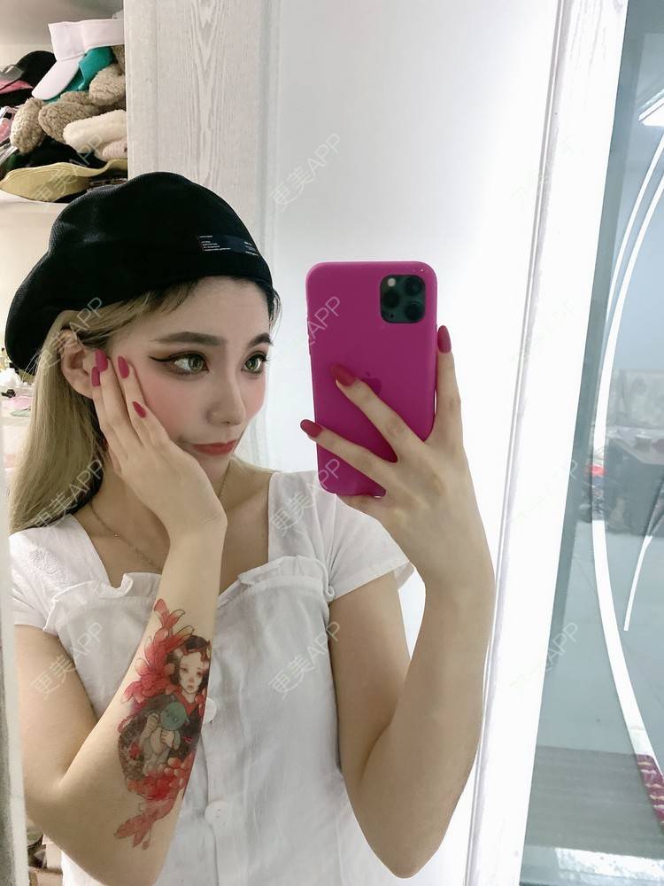 更美 - 欧美挂的全切双眼皮经验 | 全切双眼皮 | 南京