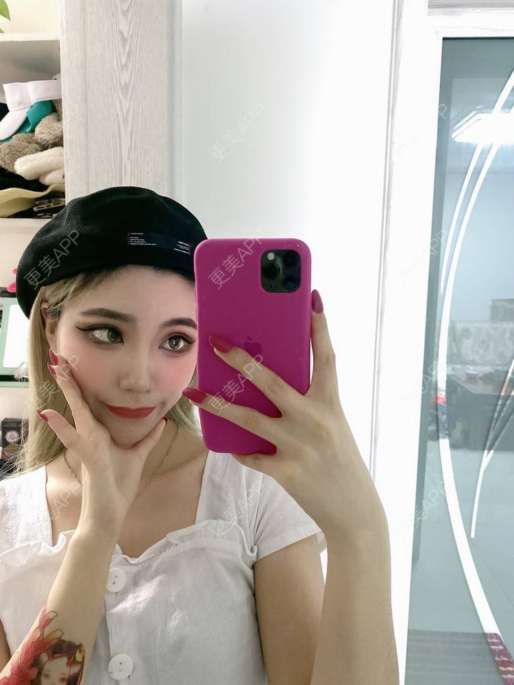 更美 - 欧美挂的全切双眼皮经验 | 全切双眼皮 | 南京