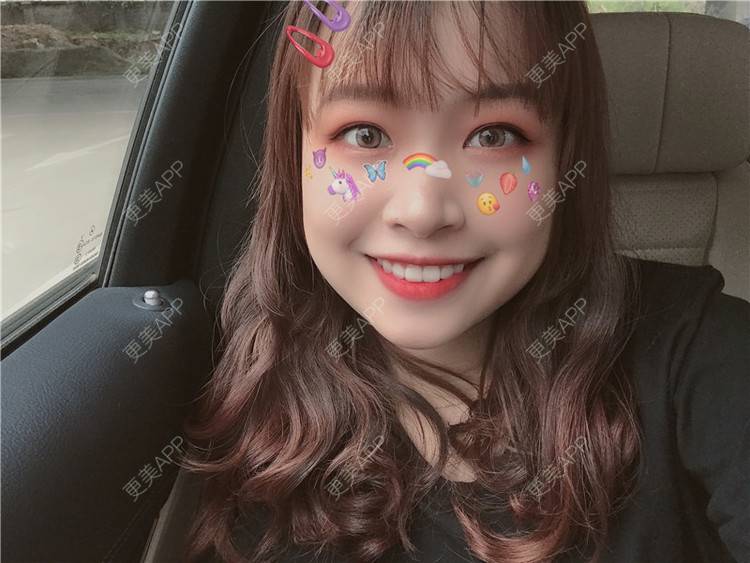 更美 - ε给我一个晚安吻孟的超声波洗牙经验 | 武汉 | 超声波洗牙