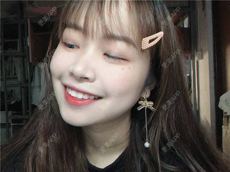 更美 - ε给我一个晚安吻孟的超声波洗牙经验 | 武汉 | 超声波洗牙