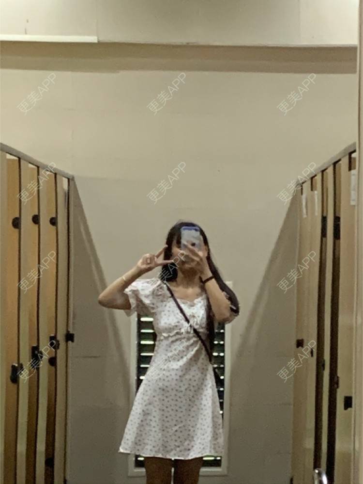 更美 - 你长得可真香的注射塑形腿部经验 | 注射塑形腿部 | 成都