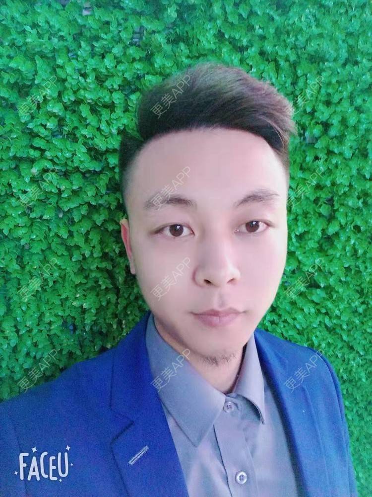 更美 - 今天敲代码了吗的植发际线经验 | 广州 | 视频日记 | 植发际线