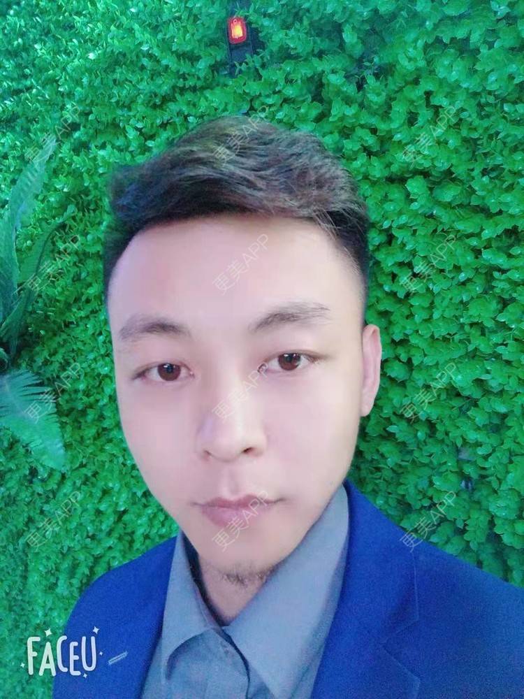 更美 - 今天敲代码了吗的植发际线经验 | 广州 | 视频日记 | 植发际线