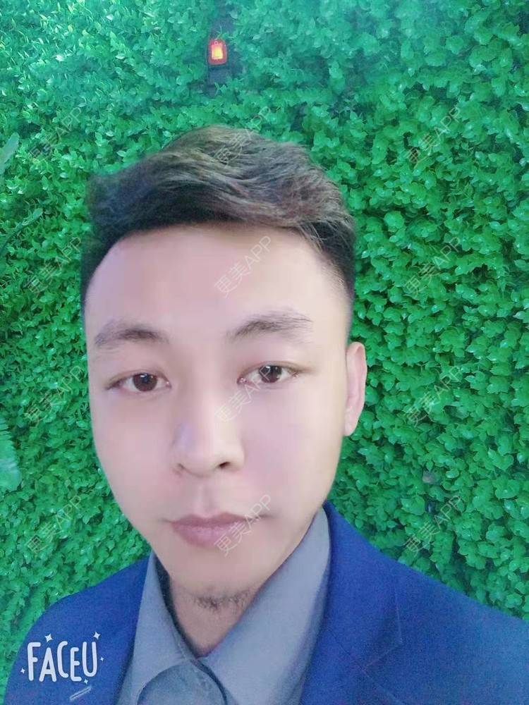 更美 - 今天敲代码了吗的植发际线经验 | 广州 | 视频日记 | 植发际线