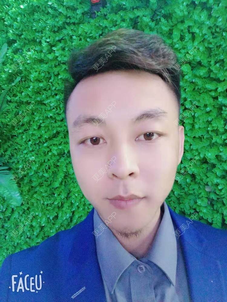 更美 - 今天敲代码了吗的植发际线经验 | 广州 | 视频日记 | 植发际线