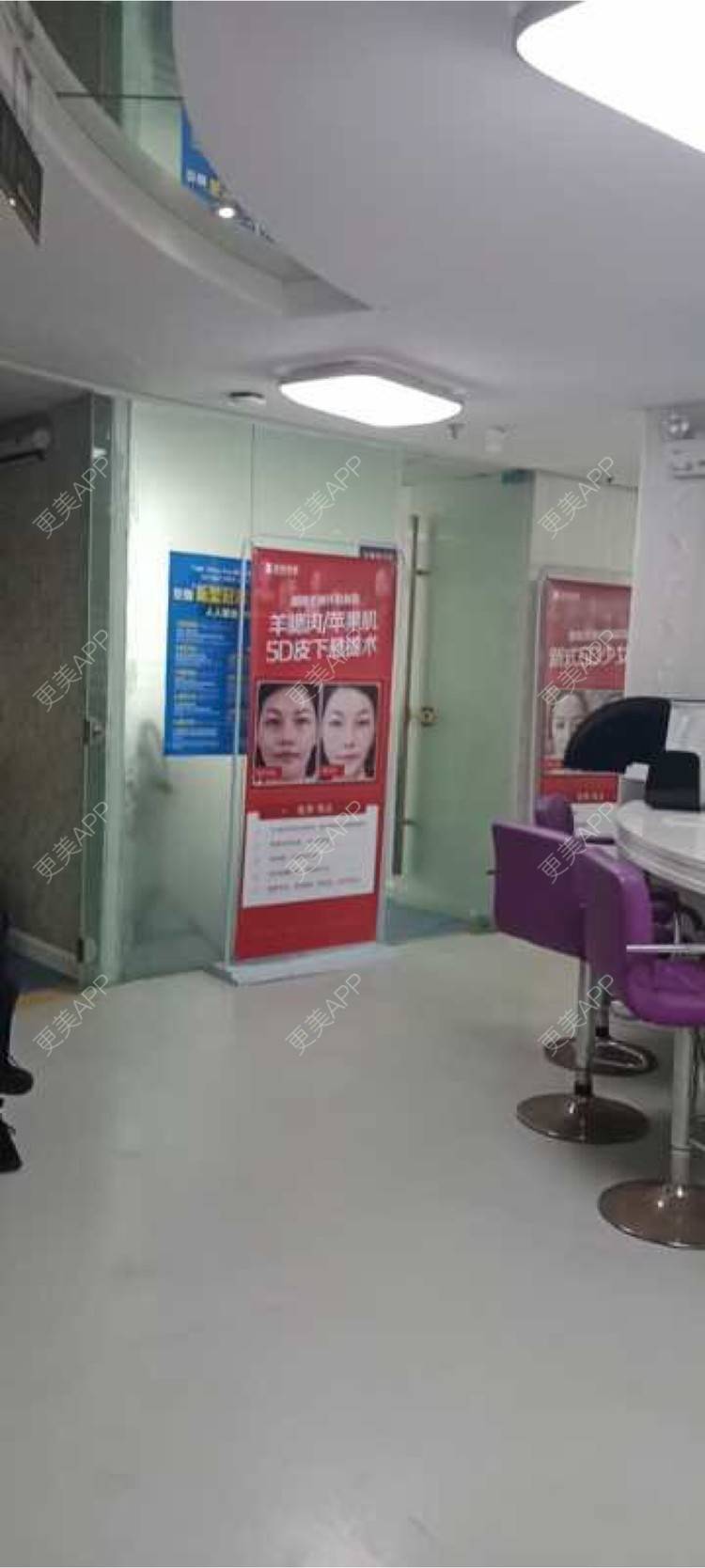 更美 - 更美用户m4NI0zC0pP的埋线提升经验 | 深圳 | 埋线提升