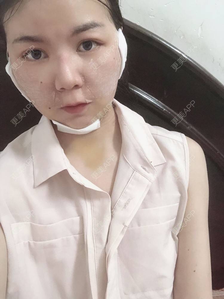 更美 - _对不起，滚远了荣的激光去脂肪粒经验 | 激光去脂肪粒 | 武汉
