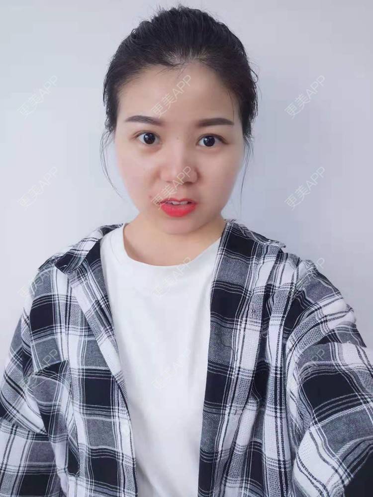 更美 - _对不起，滚远了荣的激光去脂肪粒经验 | 激光去脂肪粒 | 武汉