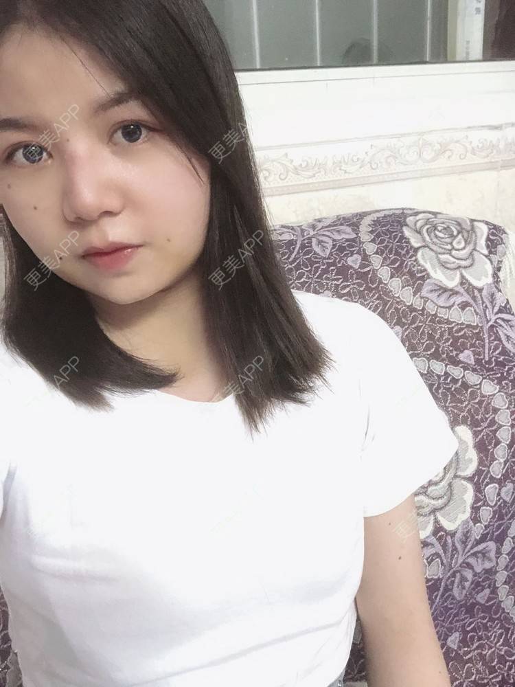 更美 - _对不起，滚远了荣的激光去脂肪粒经验 | 激光去脂肪粒 | 武汉