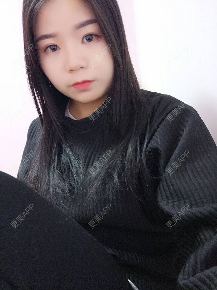 更美 - _对不起，滚远了荣的激光去脂肪粒经验 | 激光去脂肪粒 | 武汉