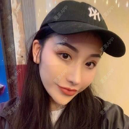 更美 - 爱里承欢一的硅胶垫眉弓经验 | 硅胶垫眉弓 | 武汉