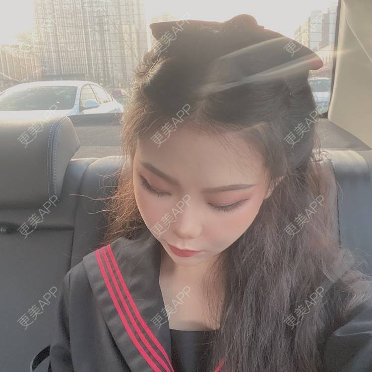 更美 - 天使爱美丽1的下颌角切除经验 | 广州 | 视频日记 | 下颌角切除