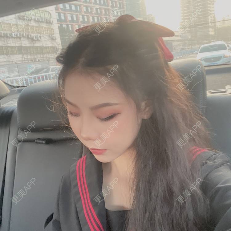 更美 - 天使爱美丽1的下颌角切除经验 | 广州 | 视频日记 | 下颌角切除