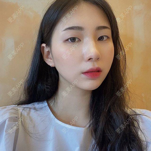 更美 - 更美用户uCjzLzFT2B的注射除腋臭经验 | 祛腋臭 | 注射除腋臭 | 上海