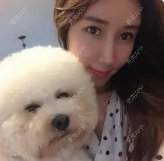 更美 - 更美用户4vfE69H4nt的垫眉弓经验 | 垫眉弓 | 硅胶垫眉弓 | 上海