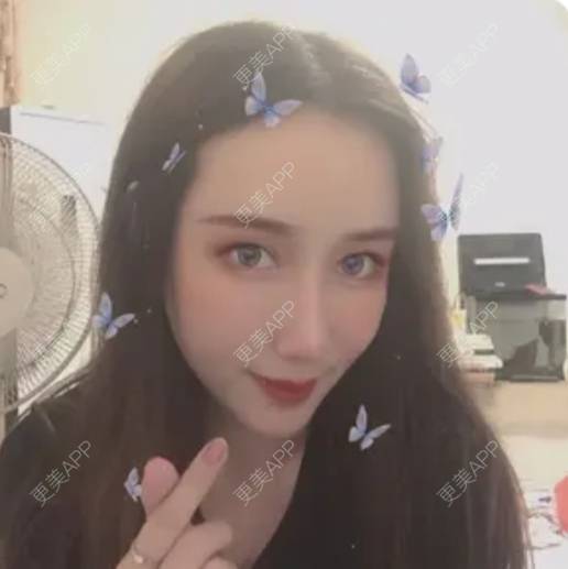 更美 - 更美用户4vfE69H4nt的垫眉弓经验 | 垫眉弓 | 硅胶垫眉弓 | 上海