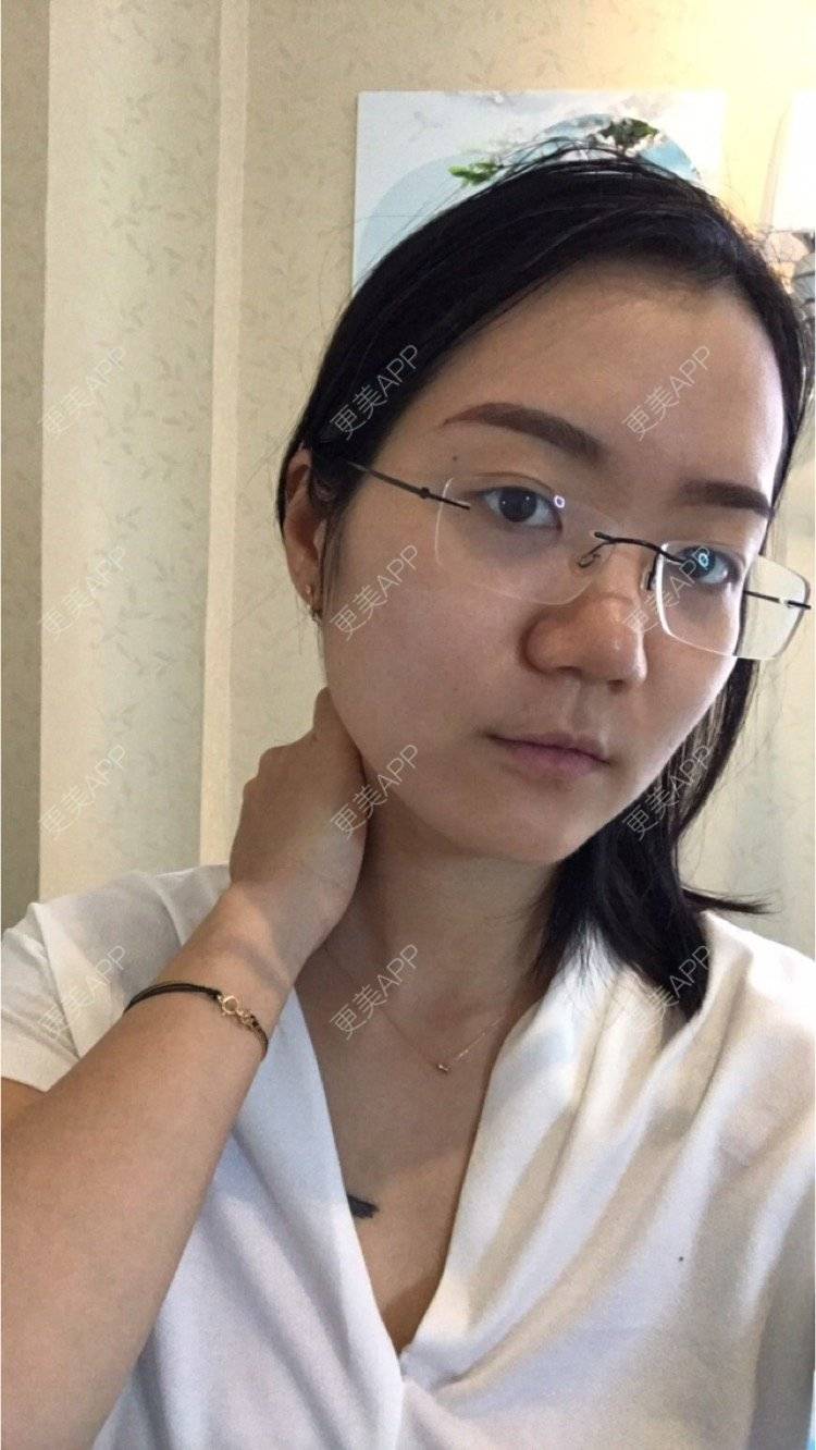 更美 - Timo活得漂亮的半永久纹眉经验 | 武汉 | 半永久纹眉