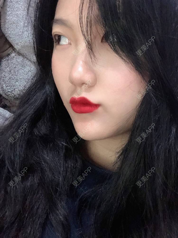 更美 - 男朋友是彭于晏的M唇成形经验 | M唇成形 | 杭州