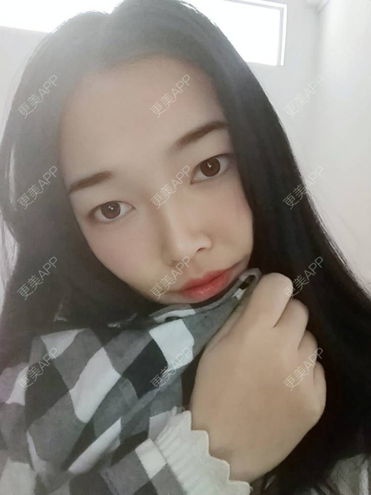 更美 - 更美用户d3VL5UQGsk的热拉提经验 | 上海 | 热拉提