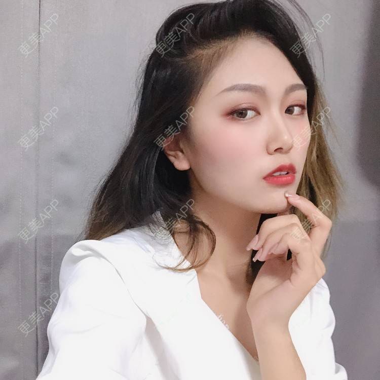 更美 - 更美用户qtK18iJ3fY的朝天鼻矫正经验 | 朝天鼻矫正 | 鼻翼缩小 | 福州 | 人工骨隆鼻 | 真皮隆鼻 | 长鼻矫正