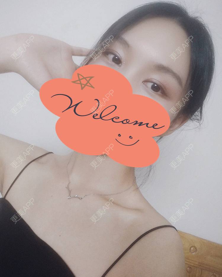 更美 - 更美用户1fHxMDJVIE的眼部多项经验 | 眼部多项 | 广州