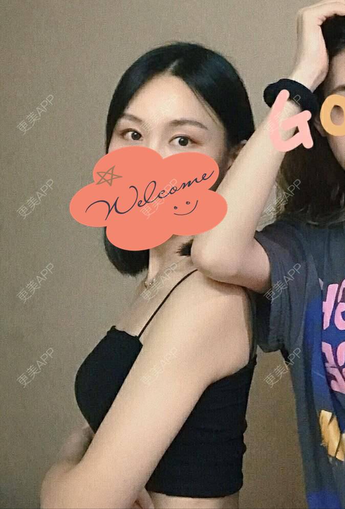 更美 - 更美用户1fHxMDJVIE的眼部多项经验 | 眼部多项 | 广州