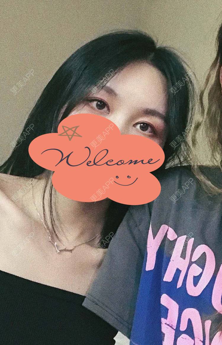 更美 - 更美用户1fHxMDJVIE的眼部多项经验 | 眼部多项 | 广州