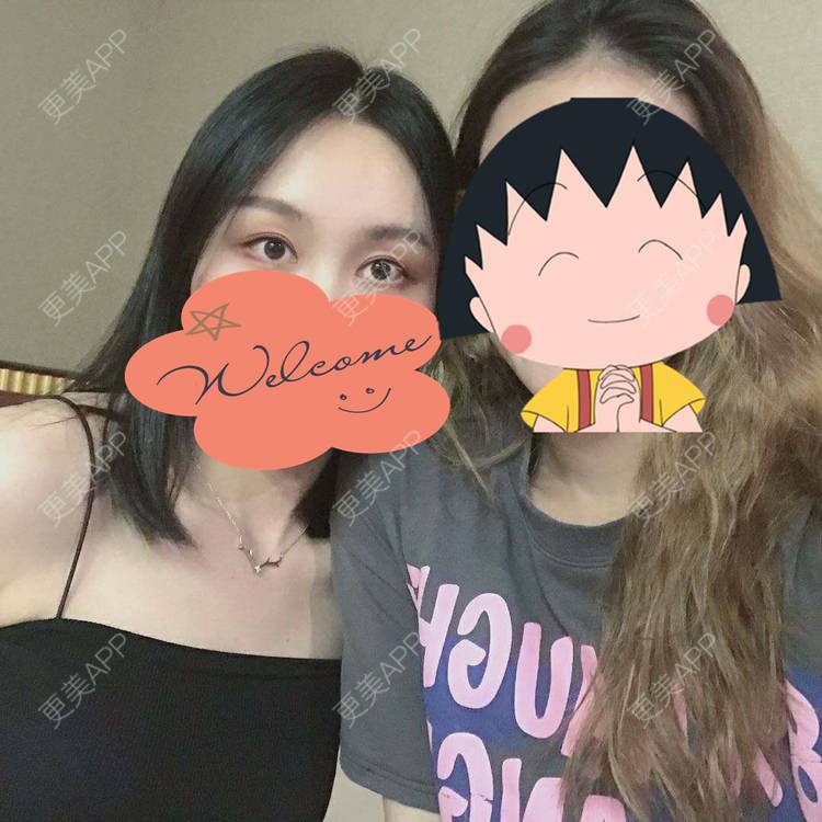 更美 - 更美用户1fHxMDJVIE的眼部多项经验 | 眼部多项 | 广州