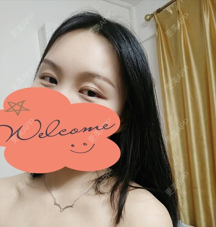 更美 - 更美用户1fHxMDJVIE的眼部多项经验 | 眼部多项 | 广州