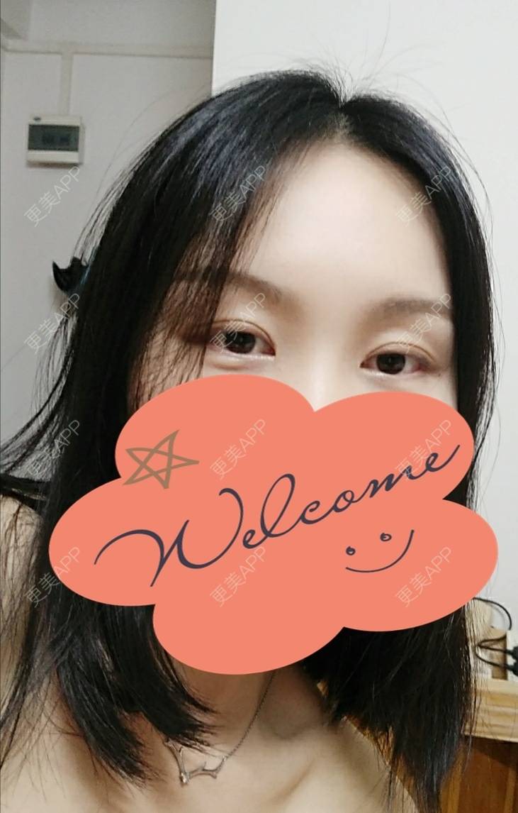 更美 - 更美用户1fHxMDJVIE的眼部多项经验 | 眼部多项 | 广州