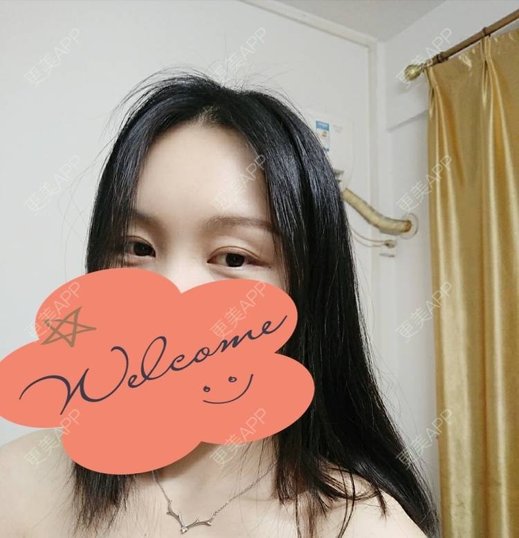 更美 - 更美用户1fHxMDJVIE的眼部多项经验 | 眼部多项 | 广州