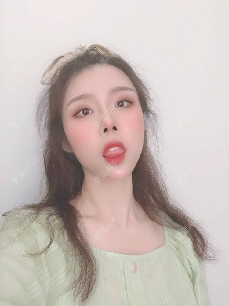 更美 - 超级超级好吃的下巴经验 | 膨体垫下巴 | 硅胶垫下巴 | 人工骨垫下巴 | 下巴