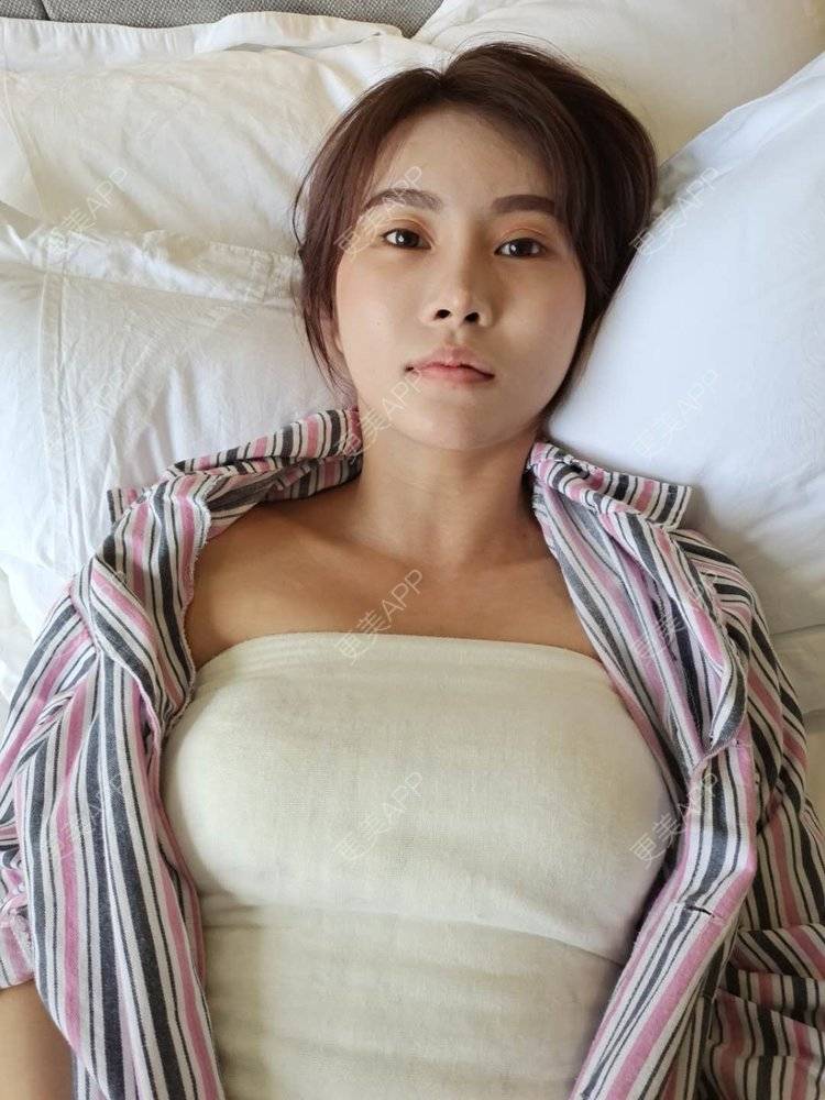 孙梦大美女的假体隆胸日记