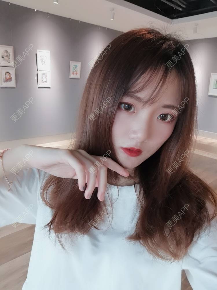 更美 - 更美用户WKQgAJmjAK的皮秒激光经验 | 皮秒激光 | 武汉