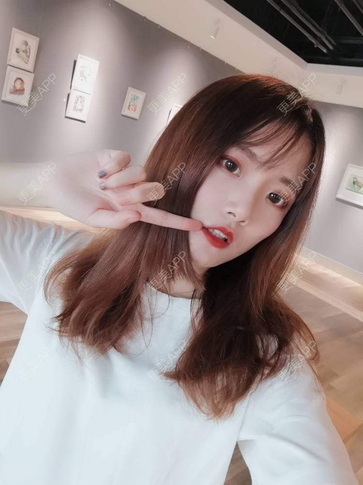 更美 - 更美用户WKQgAJmjAK的皮秒激光经验 | 皮秒激光 | 武汉