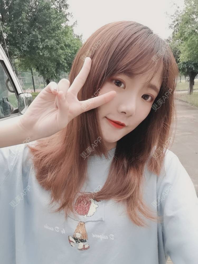 更美 - 更美用户WKQgAJmjAK的皮秒激光经验 | 皮秒激光 | 武汉