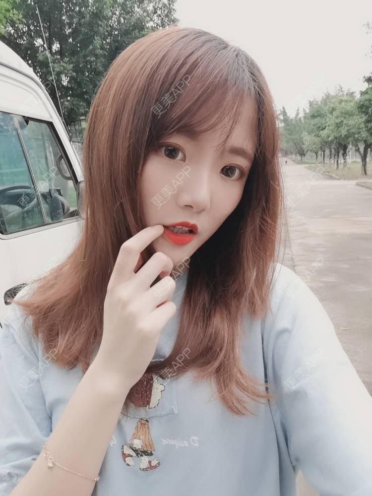 更美 - 更美用户WKQgAJmjAK的皮秒激光经验 | 皮秒激光 | 武汉