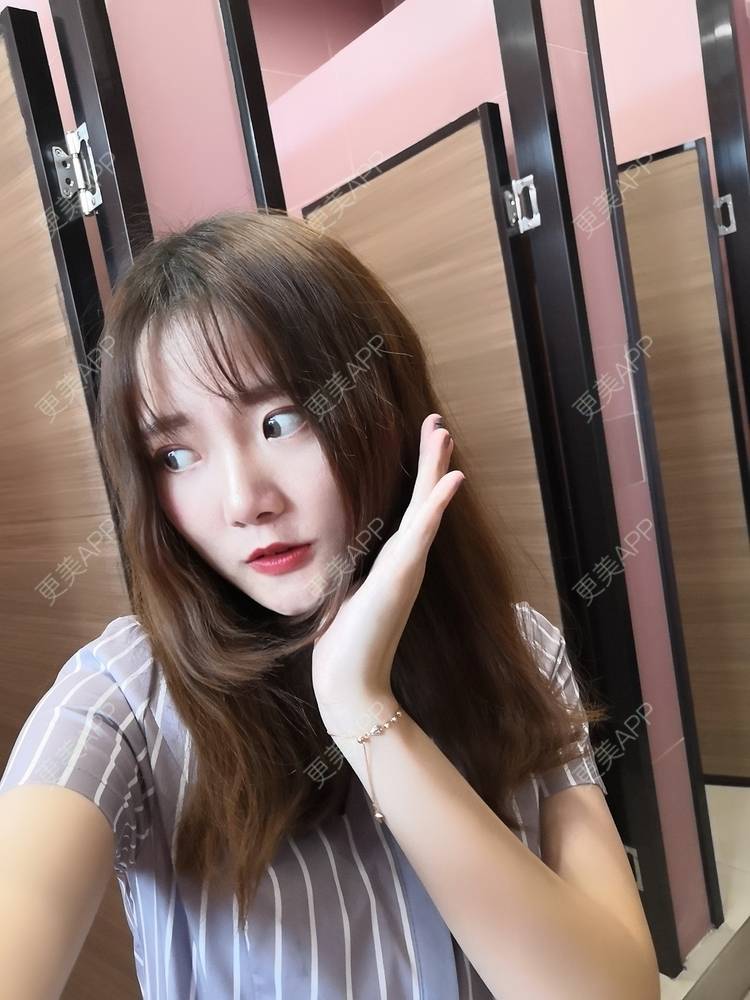 更美 - 更美用户WKQgAJmjAK的皮秒激光经验 | 皮秒激光 | 武汉