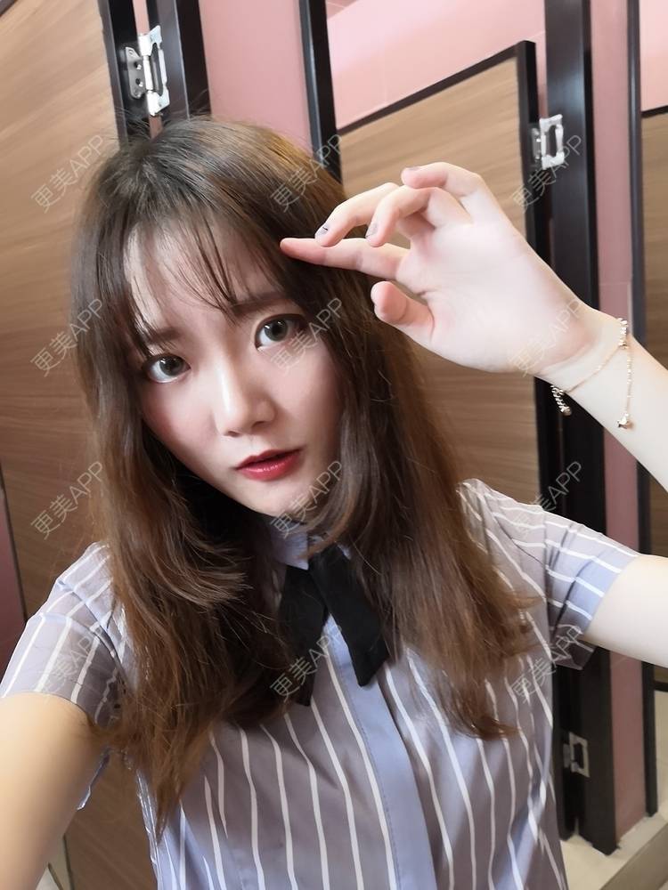 更美 - 更美用户WKQgAJmjAK的皮秒激光经验 | 皮秒激光 | 武汉