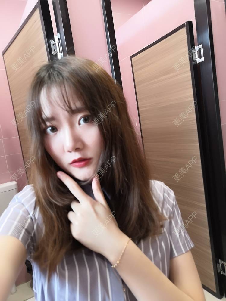 更美 - 更美用户WKQgAJmjAK的皮秒激光经验 | 皮秒激光 | 武汉