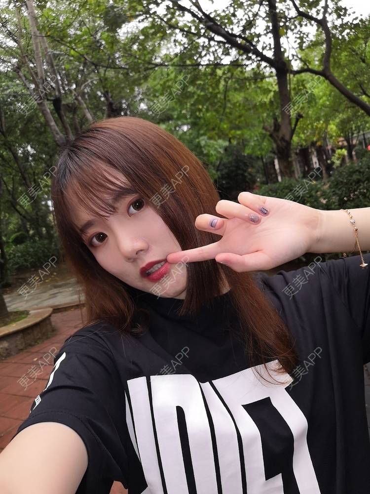 更美 - 更美用户WKQgAJmjAK的皮秒激光经验 | 皮秒激光 | 武汉