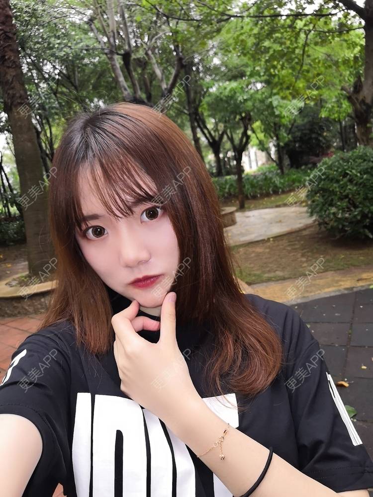 更美 - 更美用户WKQgAJmjAK的皮秒激光经验 | 皮秒激光 | 武汉