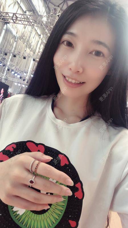 更美 - 摇滚吧姑娘的埋线提升经验 | 埋线除皱 | 昆明 | 埋线提升